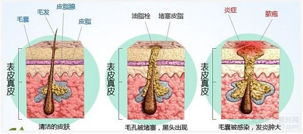 皮肤结构示意图