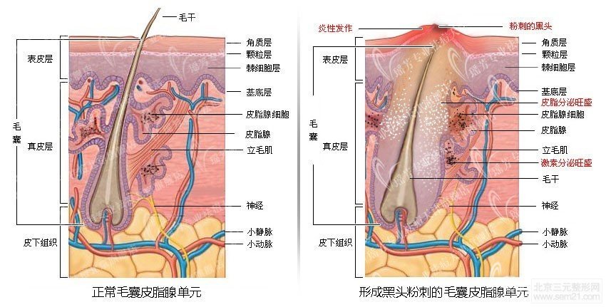 皮肤结构示意图