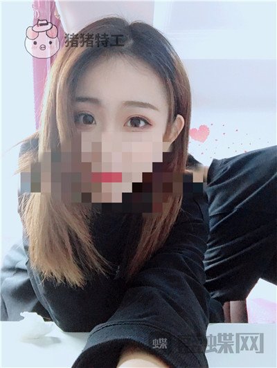 杭州美莱，韩超，双眼皮，案例，价格，