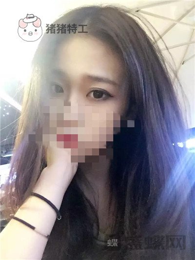 杭州美莱，韩超，双眼皮，案例，价格，