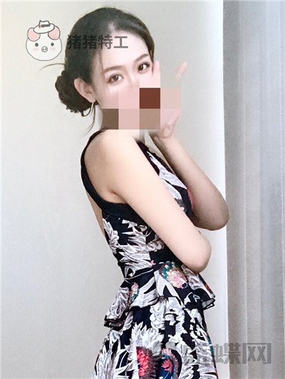 杭州美莱，韩超，双眼皮，案例，价格，