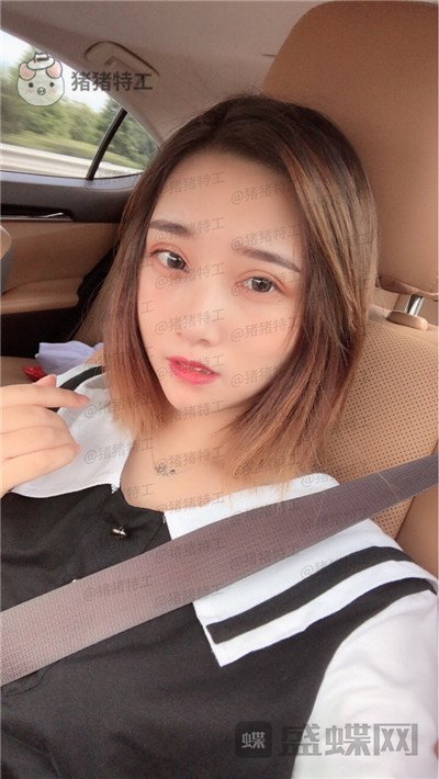 杭州格莱美，王馨婉，双眼皮，案例，价格，